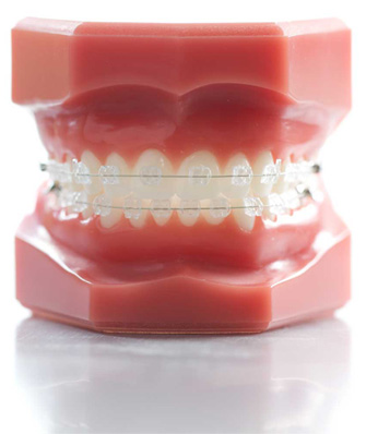 Simply Smile Braces in St Albans